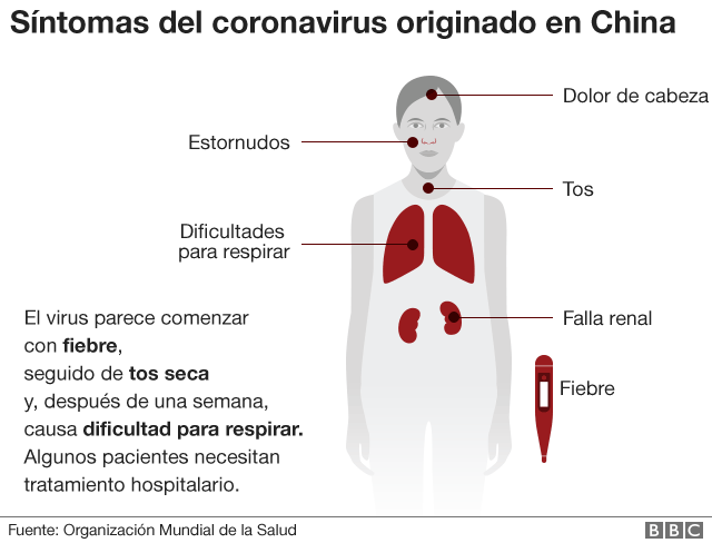 _110641152_spanish_coronavirus_symptoms_short_640-nc