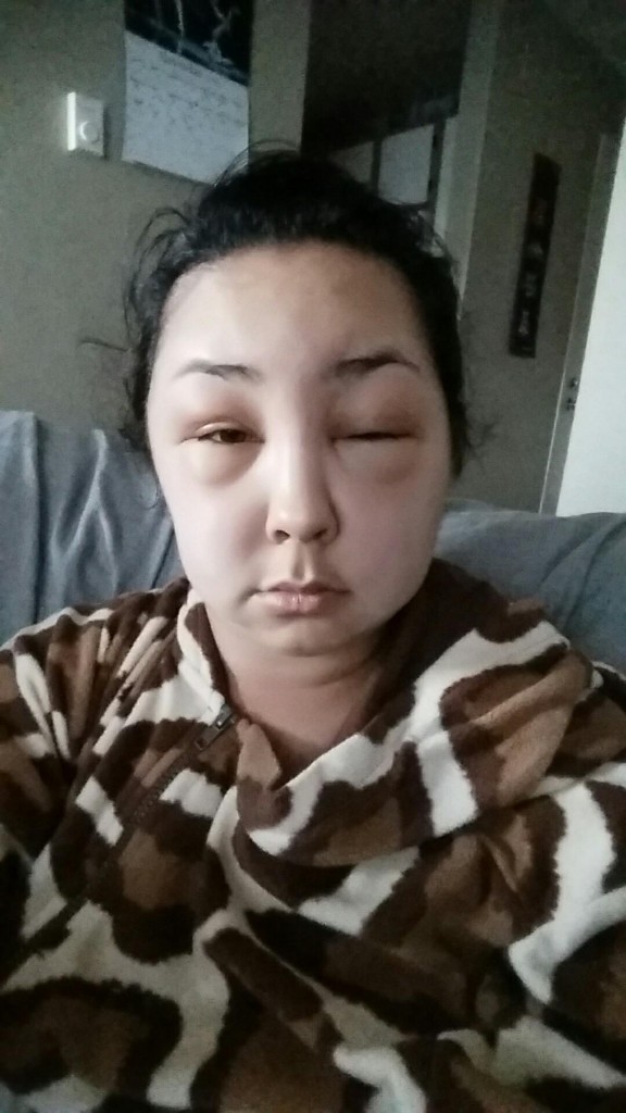 Mujer con alergia al tinte 3 bis