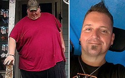 10 fotos del antes y después de personas con obesidad mórbida: Tras adelgazar, parecen otros