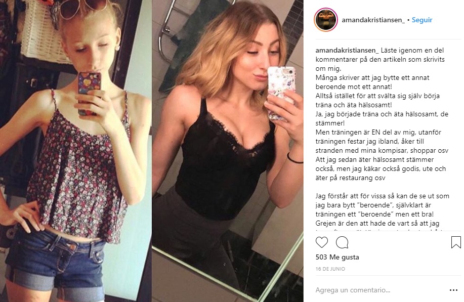 joven que se recupero de la anorexia 1