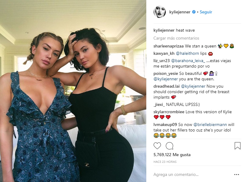 Kylie Jenner relleno labios