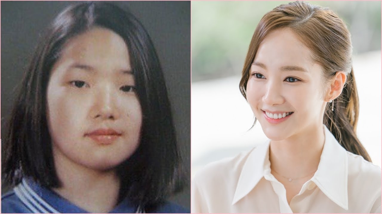 Famosas coreanas con cirugía plástica Park Min Young antes y despues