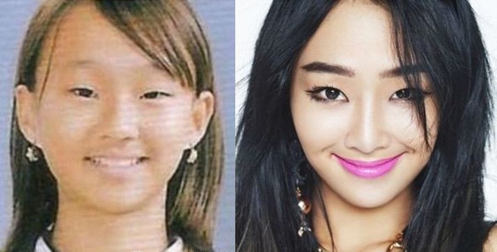 Famosas coreanas con cirugía plástica hyorin antes y despues