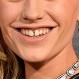Campaña de labiales muestra sonrisa “imperfecta” y se vuelve furor en Instagram