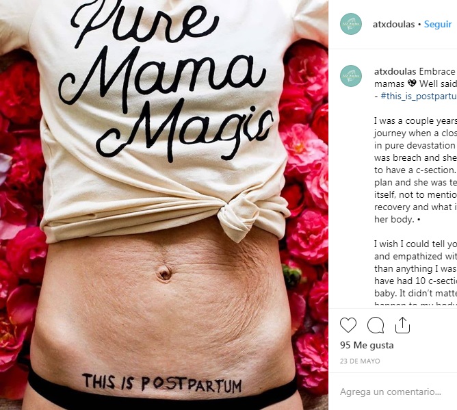 mujeres cuerpo postparto campaña 6