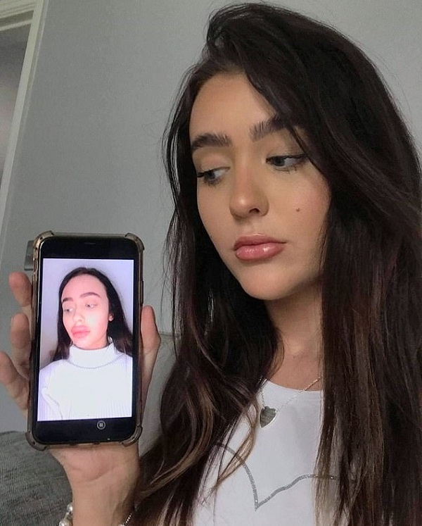 mujer relleno labios quedo mal 1
