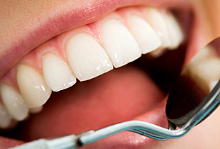 Ir al Dentista Ir al Dentista
