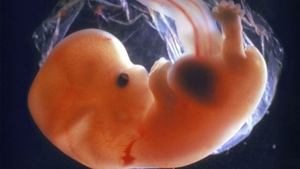 Foto: Embrión humano, imagen referencial. /vidasv.org