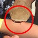 Insólitas fotos: Mujer llegó al hospital con un tiburón colgando del brazo