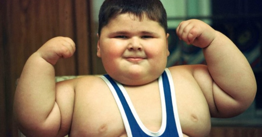 Niño_Obeso