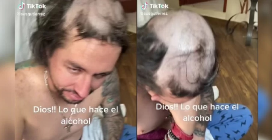 Pelo
