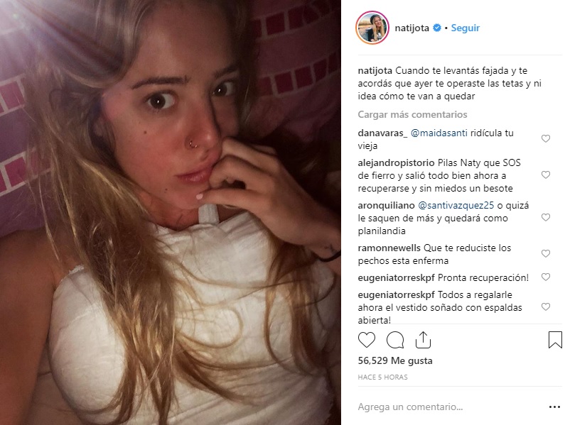 nati jota después de la operación de lolas