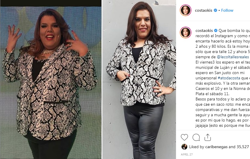 gonzalo costa cirugia antes despues