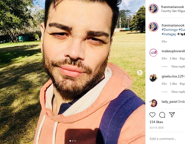 fran mariano cuestion de peso cirugias esteticas