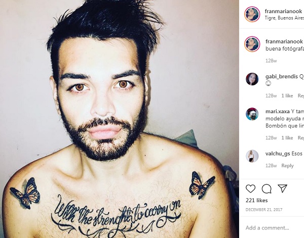 fran mariano cuestion de peso cirugias