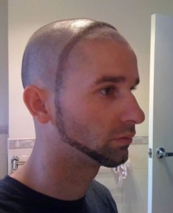 barbas raras