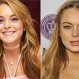 Fotos de cirugías de 11 celebridades antes y después: ¿Quedaron mejor o peor?