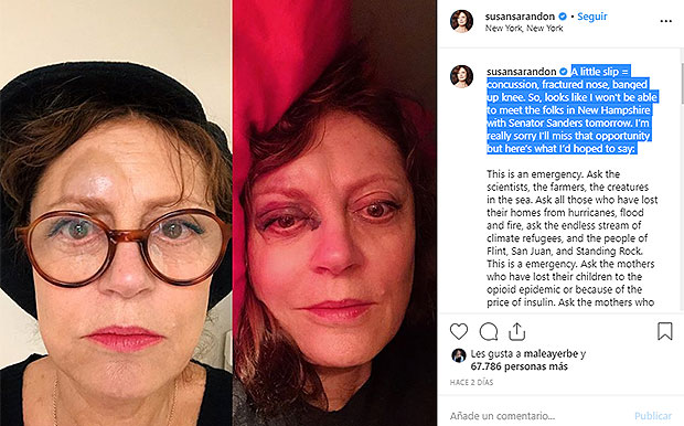 susan-sarandon-face