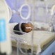 Imágenes de niño con desnutrición en Yemen muestran devastadora realidad en ese país