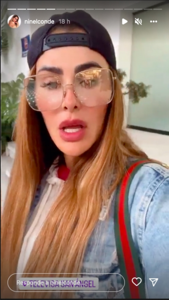 ninel-conde-cirugias5