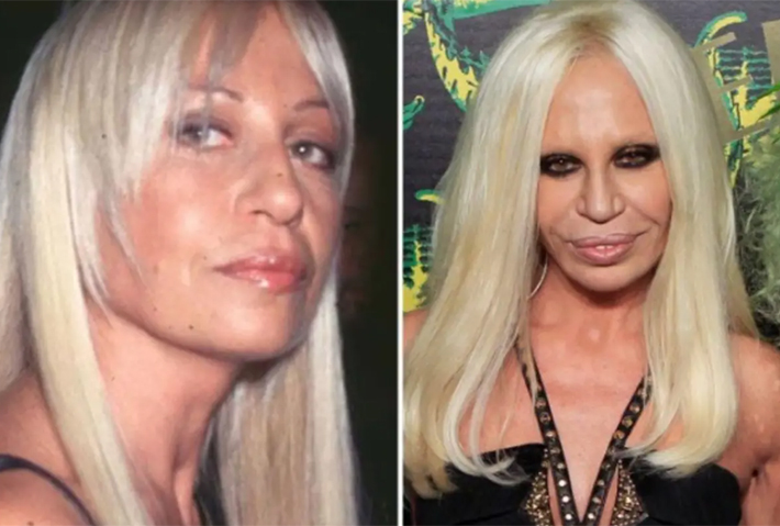 donatella-versace-fotos1
