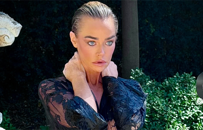 Denise Richards cirugía