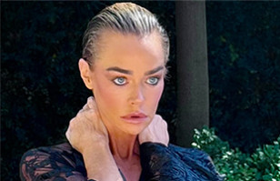 Denise Richards se somete a cirug&iacute;a y los resultados del cambio sorprenden