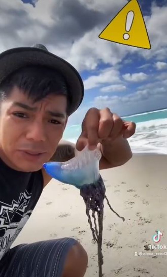 Joven toma una medusa que es extremadamente peligrosa.