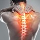 Problemas en la columna: ¿Es mejor tratar o prevenir?