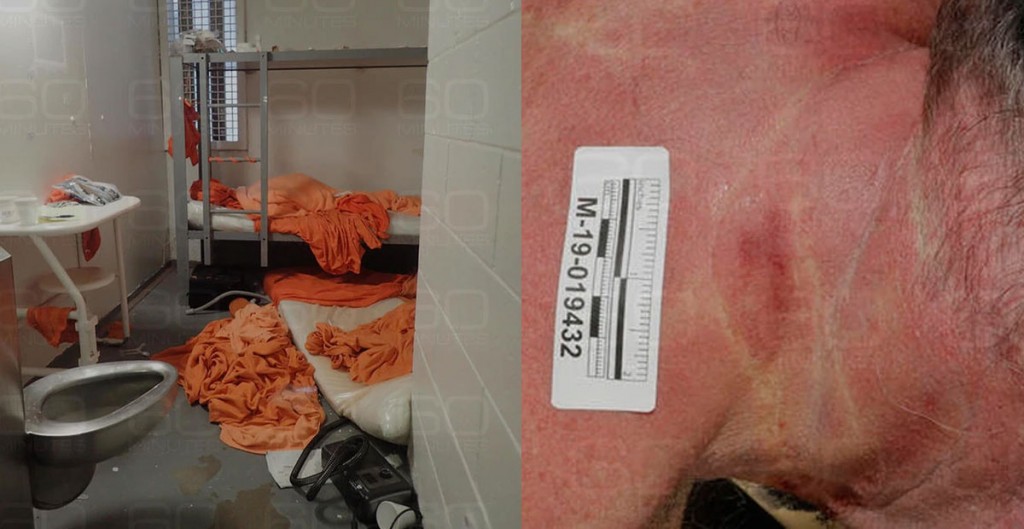 La celda donde fue encontrado el cadáver de Jeffrey Epstein y las lesiones en su cuello que quedaron tras su supuesto suicidio.