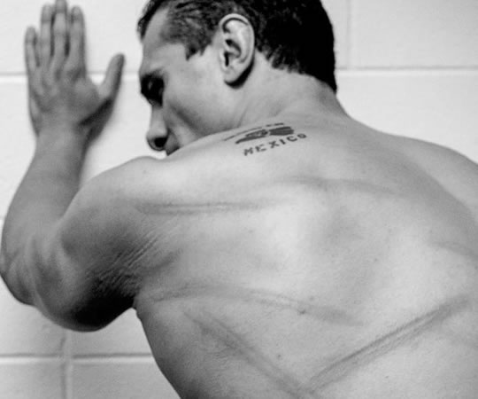 Alberto del Rio y las marcas de una muleta en su espalda