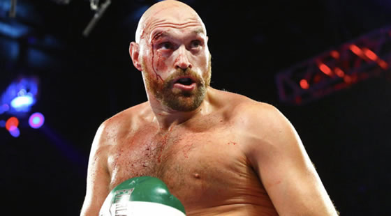 tyson-fury
