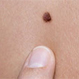 Consigue un efecto bronceado sin sol y averigua si tu piel está en riesgo de contraer cáncer