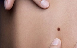 Consigue un efecto bronceado sin sol y averigua si tu piel está en riesgo de contraer cáncer