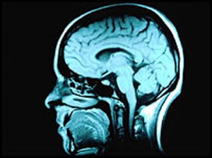 las ideologías en el cerebro humano