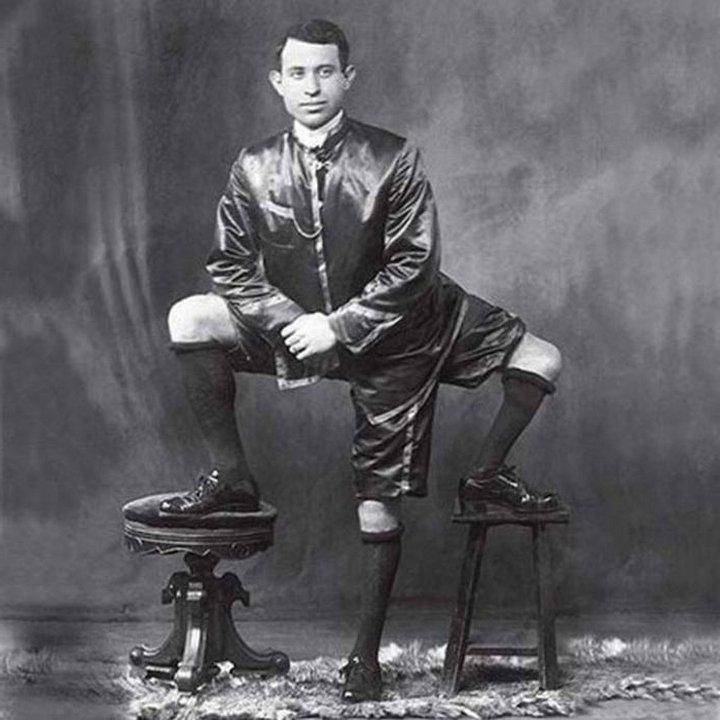 Frank Lentini.