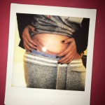 La fotografía menor que compartió Selena, su cicatriz