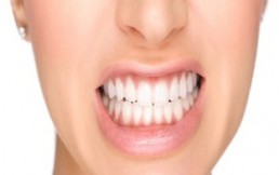 ¿Qué es el bruxismo? Cuando los dientes sufren por el estado de ánimo