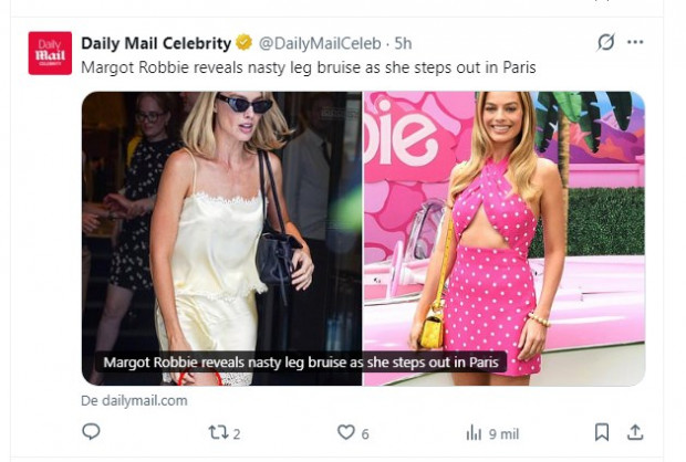 Margot Robbie encanta con su look en París, pero preocupa por detalle en una de sus piernas / Captura x.com/DailyMailCeleb