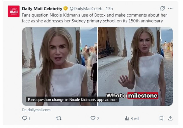 Nicole Kidman Botox