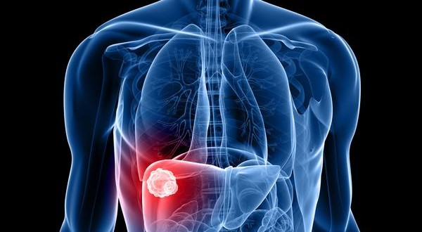 Liver_biopsy-600x330