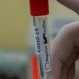 Detectaron nueva cepa del Coronavirus en Chile: La afectada es una mujer que arribó desde Madrid