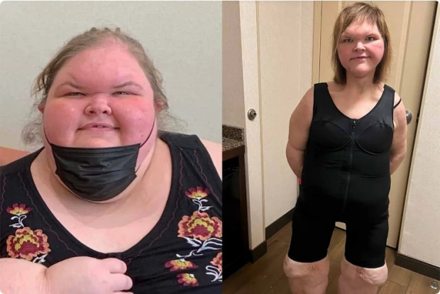 La increíble transformación de participante de un reality show: llegó a pesar 330 kilos, y ahora ostenta cerca de 100 / es-us.vida-estilo.yahoo.com