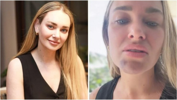 Daniela Nicolás detalló la pesadilla por la que atraviesa por rara enfermedad neurológica / www.chilevision.cl