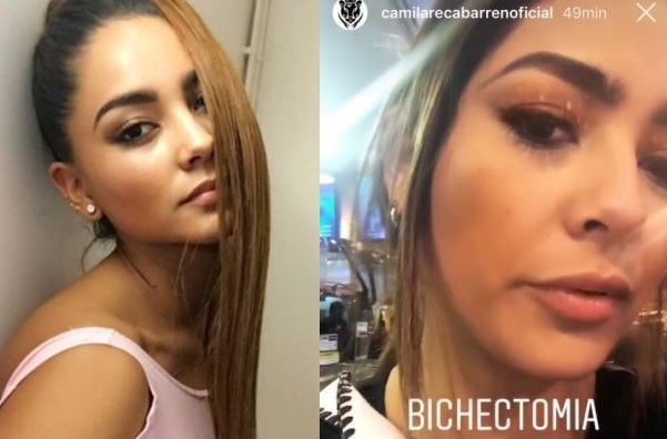 Camila Recabarren cirugía rostro
