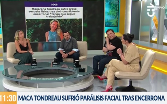 Macarena Tondreau parálisis facial
