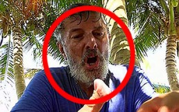 Famoso cantante español sufrió terrible picadura de un gusano marino mientras participaba en reality