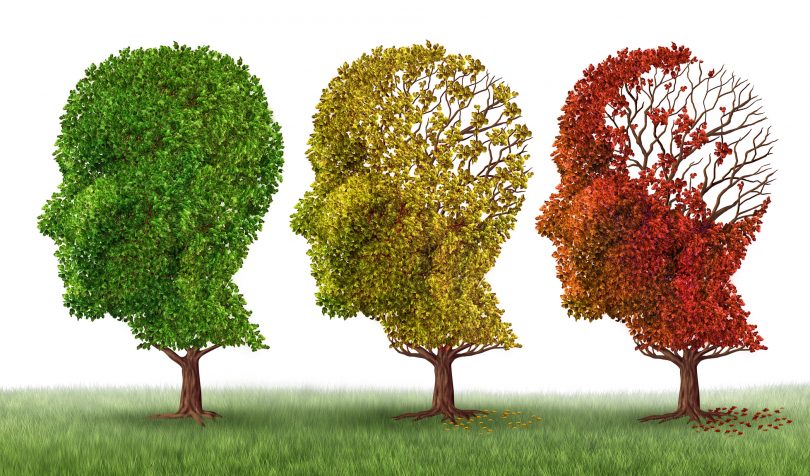 Alzheimer: ¿Qué es y cuáles son los últimos avances? Especialistas nos explican