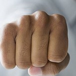 Desfiguran a joven en ataque xenófobo: “Así que sos chileno, vos te la aguantás”