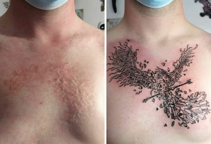 tatuaje-cicatrices2